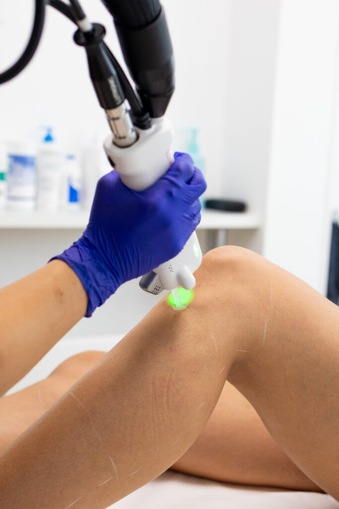 Découvrez Avicenne Esthétique à Clichy la Garenne, votre centre spécialisé en épilation laser et injections d'acide hyaluronique.