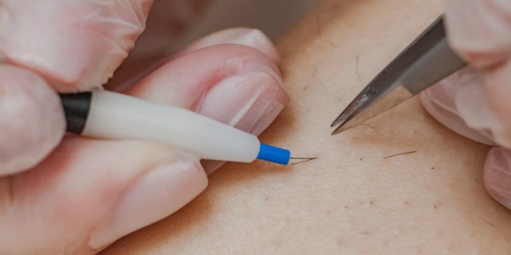 Électrolyse Avicenne esthétique